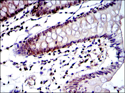Immunohistochemical analysis of paraffin-embedded colon tissues using PSMB8 mouse mAb with DAB staining.
