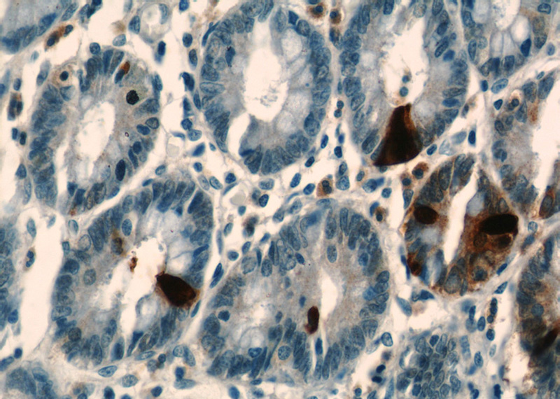 Immunohistochemical of paraffin-embedded human stomach using Catalog No:110875(GAST antibody) at dilution of 1:50 (under 40x lens)
