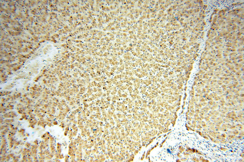 Immunohistochemical of paraffin-embedded human liver using Catalog No:111331(HACL1 antibody) at dilution of 1:100 (under 10x lens)