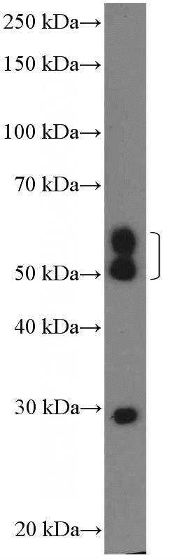 mouse brain tissue were subjected to SDS PAGE followed by western blot with Catalog No:109297(CHST2 Antibody) at dilution of 1:600