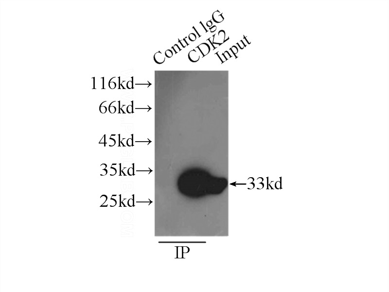 IP Result of anti-CDK2 (IP:Catalog No:109158, 3ug; Detection:Catalog No:109158 1:1500) with HeLa cells lysate 4650ug.