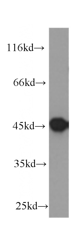 COLO 320 cells were subjected to SDS PAGE followed by western blot with Catalog No:107233(KRT20 antibody) at dilution of 1:1000