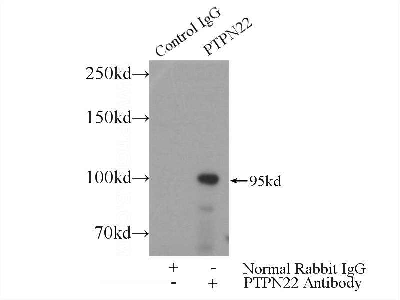 IP Result of anti-PTPN22 (IP:Catalog No:114319, 4ug; Detection:Catalog No:114319 1:300) with Jurkat cells lysate 3080ug.
