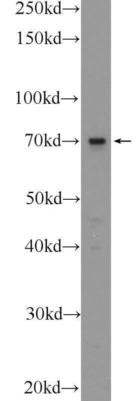 A431 cells were subjected to SDS PAGE followed by western blot with Catalog No:116080(TM9SF4 Antibody) at dilution of 1:1000