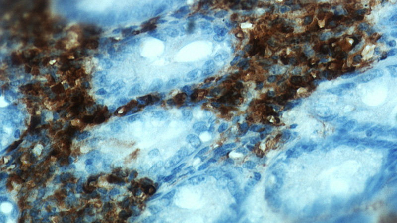 Immunohistochemical of paraffin-embedded human appendix using Catalog No:116217(TPSAB1 antibody) at dilution of 1:100 (under 40x lens)
