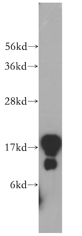 human testis tissue were subjected to SDS PAGE followed by western blot with Catalog No:113943(PLLP antibody) at dilution of 1:400