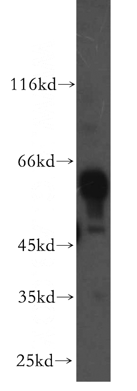 human brain tissue were subjected to SDS PAGE followed by western blot with Catalog No:114499(RABGGTA antibody) at dilution of 1:500