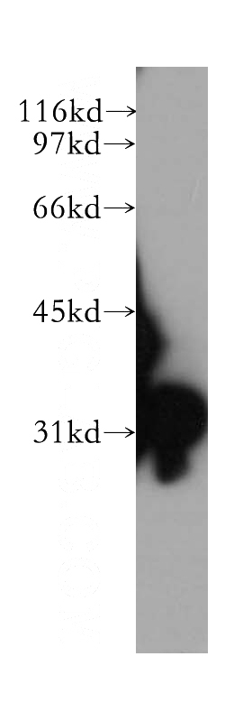 human lung tissue were subjected to SDS PAGE followed by western blot with Catalog No:115830(SULT1E1 antibody) at dilution of 1:500
