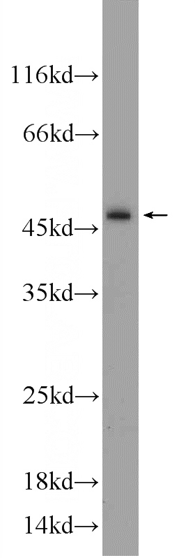 HEK-293 cells were subjected to SDS PAGE followed by western blot with Catalog No:108874(Caspase 2 Antibody) at dilution of 1:600