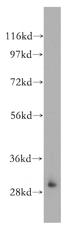 Jurkat cells were subjected to SDS PAGE followed by western blot with Catalog No:111538(HOXC4 antibody) at dilution of 1:500