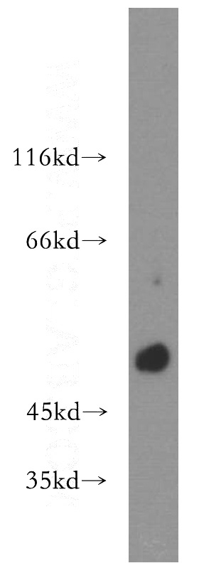 mouse heart tissue were subjected to SDS PAGE followed by western blot with Catalog No:114535(RAMP3 antibody) at dilution of 1:500