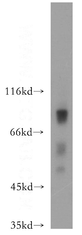 mouse testis tissue were subjected to SDS PAGE followed by western blot with Catalog No:111280(HCFC2 antibody) at dilution of 1:300
