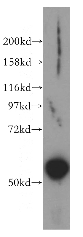 MCF7 cells were subjected to SDS PAGE followed by western blot with Catalog No:108982(CCDC6 antibody) at dilution of 1:500