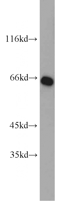 HEK-293 cells were subjected to SDS PAGE followed by western blot with Catalog No:115031(SDHA antibody) at dilution of 1:800