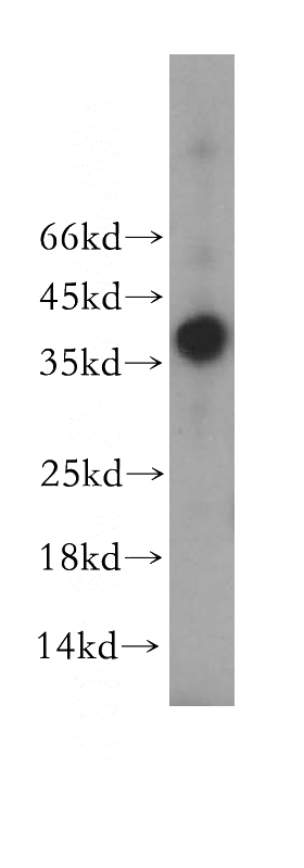 PC-3 cells were subjected to SDS PAGE followed by western blot with Catalog No:114295(PSCA antibody) at dilution of 1:500