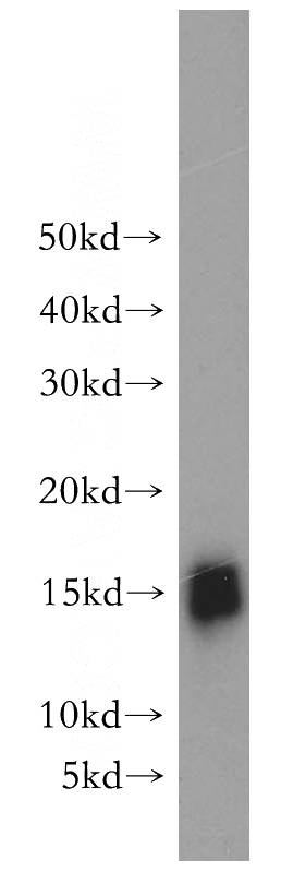human placenta tissue were subjected to SDS PAGE followed by western blot with Catalog No:110770(GABARAP antibody) at dilution of 1:500