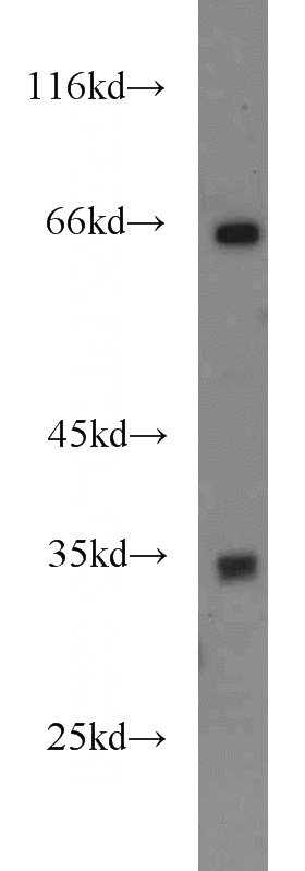 mouse liver tissue were subjected to SDS PAGE followed by western blot with Catalog No:110601(FAM78A antibody) at dilution of 1:500