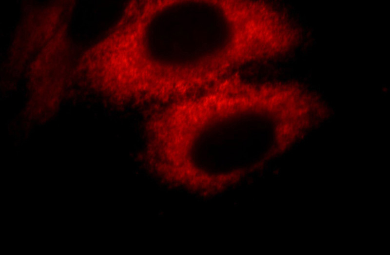 Immunofluorescent analysis of HepG2 cells, using AHSG antibody Catalog No: at 1:25 dilution and Rhodamine-labeled goat anti-mouse IgG (red).