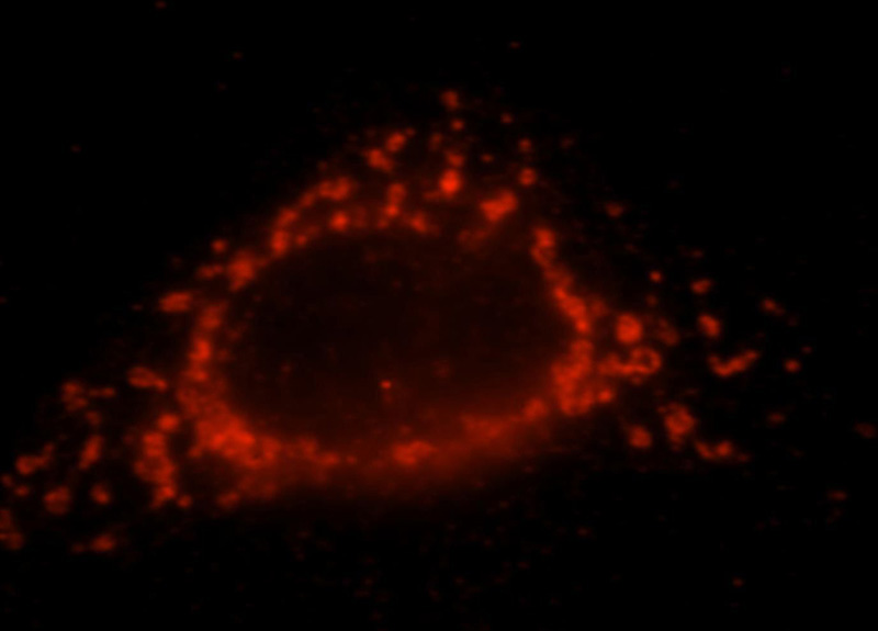 Immunofluorescent analysis of Hela cells, using NDUFS7 antibody Catalog No:113085 at 1:25 dilution and Rhodamine-labeled goat anti-rabbit IgG (red).