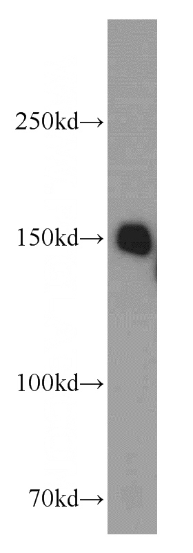 HeLa cells were subjected to SDS PAGE followed by western blot with Catalog No:114797(RPAP1 antibody) at dilution of 1:800