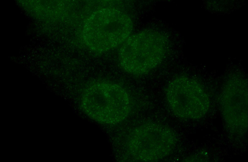 Immunofluorescent analysis of HepG2 cells using Catalog No:111534(HOXB7 Antibody) at dilution of 1:50 and Alexa Fluor 488-congugated AffiniPure Goat Anti-Rabbit IgG(H+L)