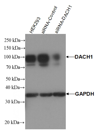 HEK293 cells (Native, siRNA-control, siRNA-DACH1) were subjected to SDS PAGE followed by western blot with Catalog No:109853 (DACH1 antibody) at dilution of 1:1000