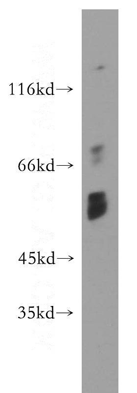 COLO 320 cells were subjected to SDS PAGE followed by western blot with Catalog No:109240(CHKA antibody) at dilution of 1:300