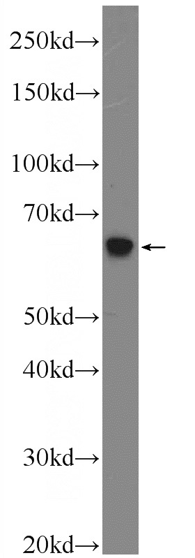 mouse testis tissue were subjected to SDS PAGE followed by western blot with Catalog No:111578(HYAL4 Antibody) at dilution of 1:300