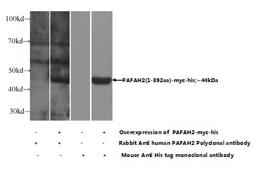 Transfected HEK-293 cells were subjected to SDS PAGE followed by western blot with Catalog No:113488(PAFAH2 Antibody) at dilution of 1:800