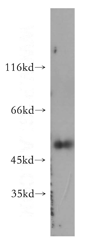 SGC-7901 cells were subjected to SDS PAGE followed by western blot with Catalog No:108877(CASP4 antibody) at dilution of 1:300