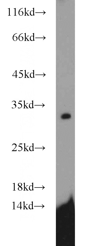HEK-293 cells were subjected to SDS PAGE followed by western blot with Catalog No:115032(SDHB antibody) at dilution of 1:1000