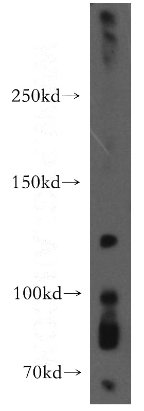 mouse brain tissue were subjected to SDS PAGE followed by western blot with Catalog No:110382(EPHA8 antibody) at dilution of 1:300