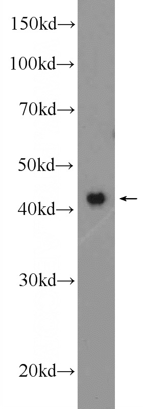 HeLa cells were subjected to SDS PAGE followed by western blot with Catalog No:113347(ZNF830 Antibody) at dilution of 1:1000