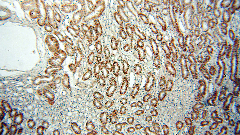 Immunohistochemical of paraffin-embedded human kidney using Catalog No:110146(FXYD5 antibody) at dilution of 1:50 (under 10x lens)