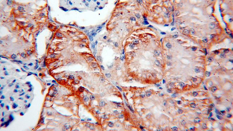 Immunohistochemical of paraffin-embedded human kidney using Catalog No:108744(CA12 antibody) at dilution of 1:50 (under 40x lens)
