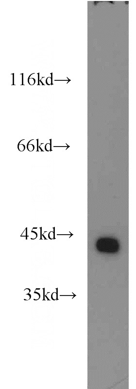 human heart tissue were subjected to SDS PAGE followed by western blot with Catalog No:111754(ILKAP antibody) at dilution of 1:1500
