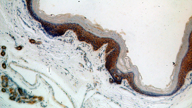 Immunohistochemical of paraffin-embedded human skin using Catalog No:114313(PTPIP51 antibody) at dilution of 1:100 (under 10x lens)