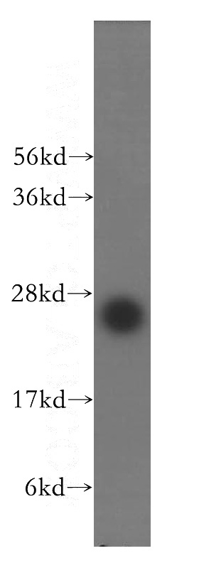 HeLa cells were subjected to SDS PAGE followed by western blot with Catalog No:110238(EMG1 antibody) at dilution of 1:400