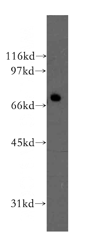 A2780 cells were subjected to SDS PAGE followed by western blot with Catalog No:114098(PPP2R1B antibody) at dilution of 1:500