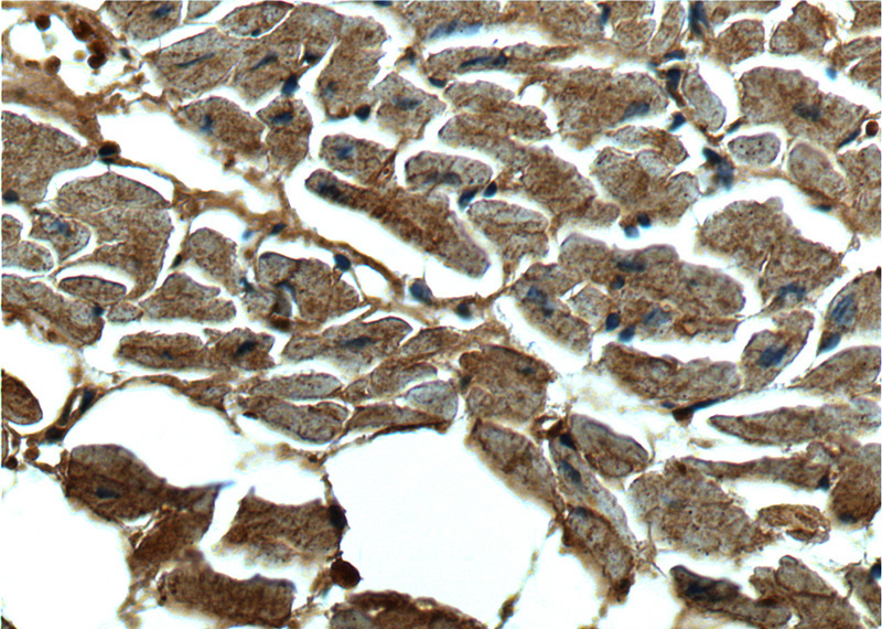 Immunohistochemistry of paraffin-embedded human heart tissue slide using Catalog No:107182(CUL4A Antibody) at dilution of 1:200 (under 40x lens).