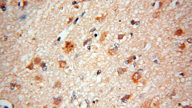 Immunohistochemical of paraffin-embedded human brain using Catalog No:107747(ACOT7 antibody) at dilution of 1:100 (under 40x lens)