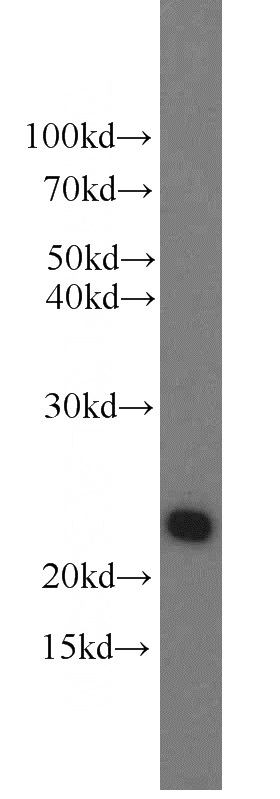 human placenta tissue were subjected to SDS PAGE followed by western blot with Catalog No:111219(GH1 antibody) at dilution of 1:800