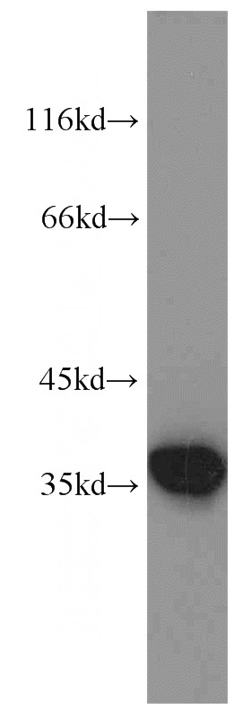 PC-3 cells were subjected to SDS PAGE followed by western blot with Catalog No:108088(ANXA1 antibody) at dilution of 1:2000