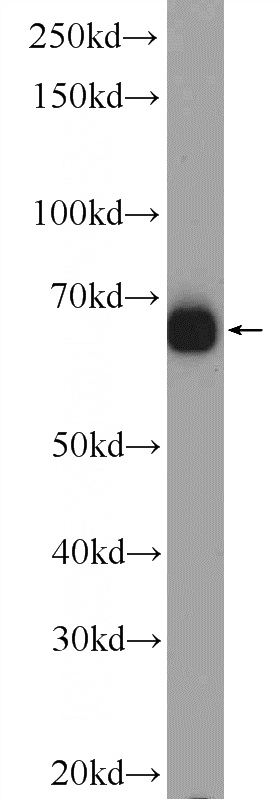 Jurkat cells were subjected to SDS PAGE followed by western blot with Catalog No:117181(ZNF48 Antibody) at dilution of 1:600