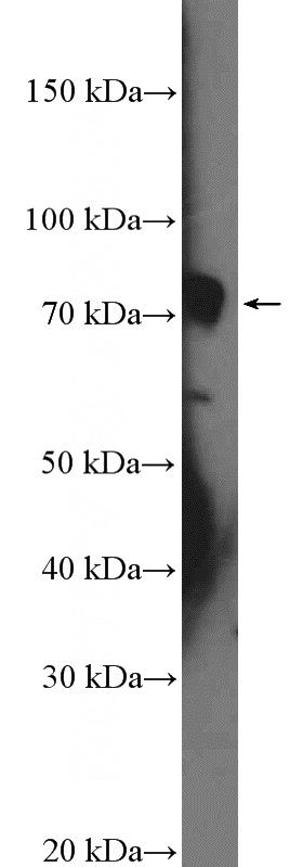 K-562 cells were subjected to SDS PAGE followed by western blot with Catalog No:114912(RPS6KA1 Antibody) at dilution of 1:300