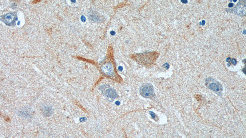 Immunohistochemistry of paraffin-embedded human brain tissue slide using Catalog No:113910(PINK1 Antibody) at dilution of 1:50 (under 40x lens).