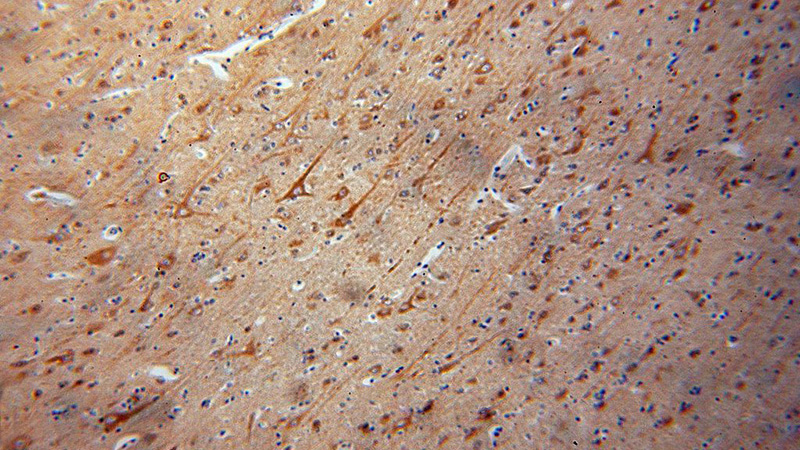 Immunohistochemical of paraffin-embedded human brain using Catalog No:115530(SPAG16 antibody) at dilution of 1:100 (under 10x lens)
