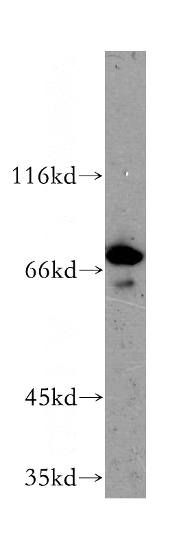 Y79 cells were subjected to SDS PAGE followed by western blot with Catalog No:112749(MPP5 antibody) at dilution of 1:400
