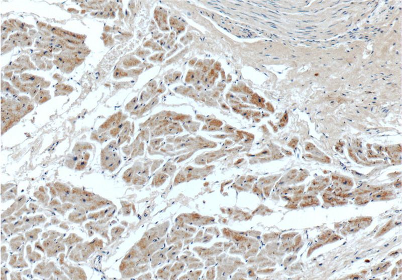 Immunohistochemistry of paraffin-embedded human heart tissue slide using Catalog No:115112(SEPN1 Antibody) at dilution of 1:50 (under 10x lens)