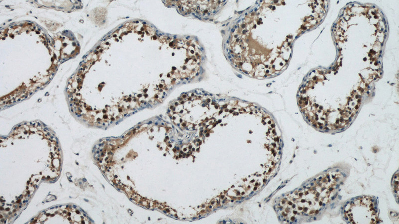 Immunohistochemical of paraffin-embedded human testis using Catalog No:116915(ZBTB38 antibody) at dilution of 1:50 (under 10x lens)